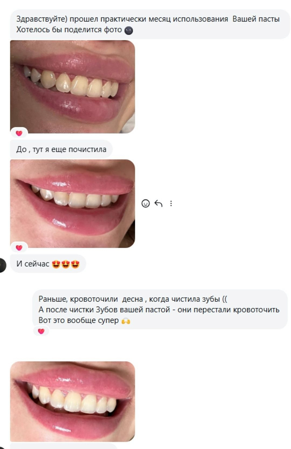 Набор для реминерализации и комплексного ухода за полостью рта BOTANİC SMİLE +